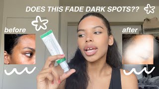 AXISY Dark Spot Correcting Glow Serum Review  Best serum for acne spot  Serum  ROBYY [upl. by Witt]