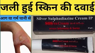 Sos cream review in Hindi  Sos cream for burn  Sos cream kis kaam aati hai [upl. by Kearney]