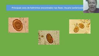 Técnicas laboratoriais II Aula 10 Atlas parasitológico Vídeo aula [upl. by Atnoed]