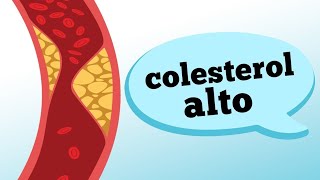 Orientações Nutricionais para Hipercolesterolemia colesterol alto [upl. by Arekat]