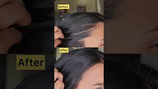 Hair Fall Solution  Kavitha Naga vlogs  Adi Reddy  How to control hair fall [upl. by Howe]