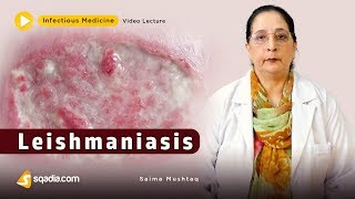 Leishmaniasis  Infectious Clinical Medicine Video  VLearning  sqadiacom [upl. by Dunham936]