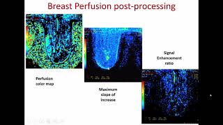 MRI PLANNNING TECHNIQUES ampTRICKS FOR IMAGING [upl. by Ulda522]