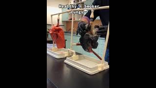 normal lungs vs smoker lungs [upl. by Wendall799]