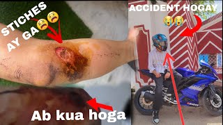 Friends Accident Hogaya 😭😭stitches ay ga ab  worst crash🤕  amaan squadviral bike total loss😔😔 [upl. by Aikal685]