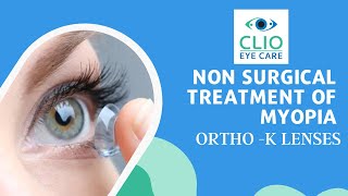 Non Surgical Treatment of Myopia  ORTHO K Lenses  Clio Eye Care [upl. by Naerol]