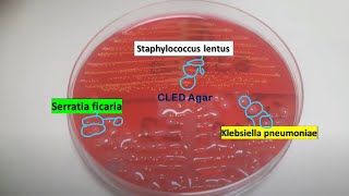 Staphylococcus lentus Klebsiella pneumoniae and Serratia ficaria on CLED Agar of Urine Culture [upl. by Ykcub500]