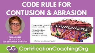 Code Rule for Contusion and Abrasion  CCO Medical Coding Tips [upl. by Eeryt]