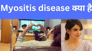 myositismyositis diseasemyositis Samanthamyositis symptomsmyositis disease in Hindi [upl. by Yelrebmik]