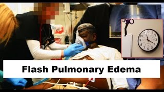 Flash Pulmonary Edema Emergency [upl. by Llehcor]