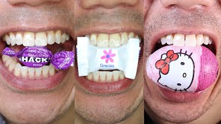 Doctor Tristan Pehs ASMR Chewing Sounds You Cant Miss [upl. by Taryne]