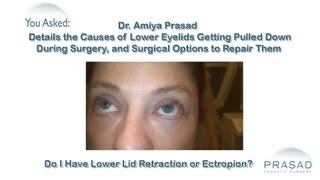 How Sagging Eyelid Skin Caused by Previous Surgery Can be Repaired [upl. by Wind]