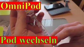 OmniPod Schlauchlose Insulinepumpe OmniPod wechseln Diabetes Typ1 Diabetes Schweiz [upl. by Airogerg]