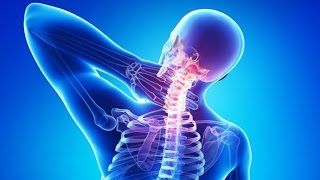 ▼Лечение Остеохондроза и Остеопороза▼▼Lechenie Osteohondroza i Osteoporoza▼ [upl. by Ainet334]