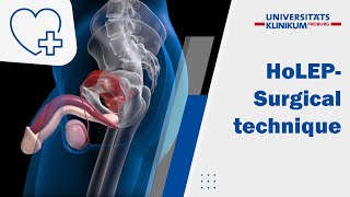 What is Holmium Laser Enucleation of the Prostate l Manipal Hospitals Bengaluru [upl. by Ewolram]