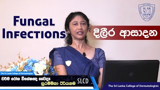 Fungal Infections දිලීර ආසාදන  Dr Surammika Eriyagama Consultant Dermatologist skincare [upl. by Aissila]