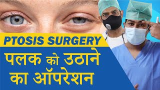 Ptosis Treatment  Droopy Eyelid Treatment  Oculoplastic Surgery for Ptosis at Eye7 Eye Hospitals [upl. by Alled]