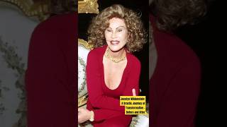 Jocelyn Wildenstein A Drastic Journey of Transformation  Before and Aftershorts [upl. by Laurella]