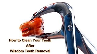 How To Clean Your Teeth After Wisdom Teeth Removal [upl. by Elita]