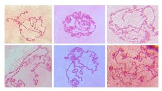 Images of polytene chromosome of Drosophila sp X150 X400 amp X1000 [upl. by Anivla]