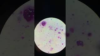 Sputum AFB slide microscope sputum afb laboratory viralshort [upl. by Hras916]