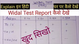 घर पर टायफायड रिपोर्ट कैसे चैक करें  How To Read Typhoid Widal Test Report At Home [upl. by Oneladgam]