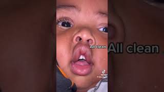 BOOGER Removal from BABY compilation video [upl. by Chalmers]