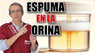 5 MOTIVOS principales de ESPUMA en la ORINA ¡Uno es ENFERMEDAD renal [upl. by Akinod]