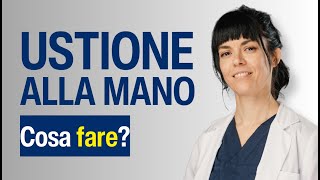 Ustione alla Mano  Cosa fare [upl. by Nahtanod]