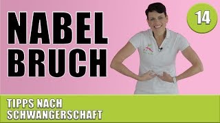 Nabelbruch  Nabelhernie nach Schwangerschaft  Nabelbruch OP  Leistenbruch  Bauchwandbruch [upl. by Vial718]