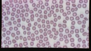 Blood Smear Evaluation [upl. by Artek]