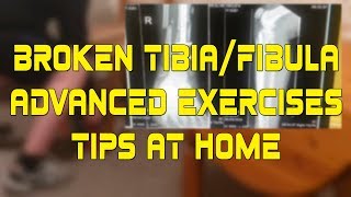 Broken TibiaFibula  Update amp Advanced Exercises [upl. by Gentille]