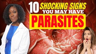 10 Shocking Signs You May Have Parasites [upl. by Ramraj]