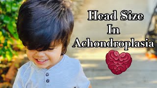 MACROCEPHALY IN ACHONDROPLASIA  Why a Large Head is One of the Features of Achondroplasia [upl. by Ber]