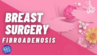 3 Breast Fibroadenosis  التضخم الغدى [upl. by Ot]