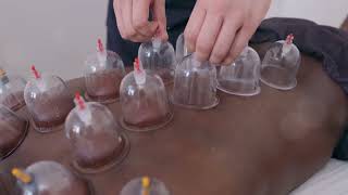 Medical Vacuum Cupping Therapy [upl. by Pyne]