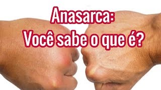 Anasarca Significado  O que é  Causas e Tratamentos [upl. by Otrebilif703]