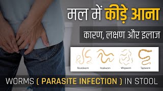 लैट्रिन में कीड़े  Stool Me Kide  Latrine Me Kide Ka Ilaj  लैट्रिन में कीड़े क्यों आते है [upl. by Sitto]