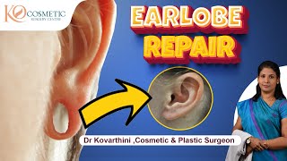 Ear Lobe Repair Surgery  Ko Cosmetic Surgery Centre  Dr Kovarthini Cosmetic and Plastic Surgeon [upl. by Aranaj]