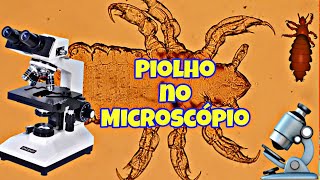 PIOLHO no MICROSCÓPIO [upl. by Osgood637]