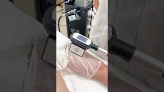 Get rid of cellulite with fat freezing a cool noninvasive solution to body sculpting fatfreezing [upl. by Milman]