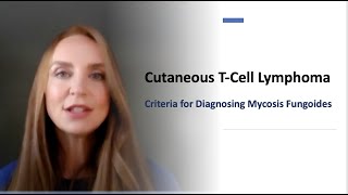 Criteria to Diagnose Mycosis Fungoides Chapter 1 [upl. by Nalorac]