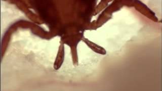 The process of attachment of a nymphal Ixodes ricinus tick to host skin [upl. by Tik886]