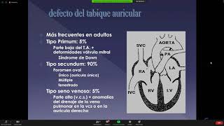 Cardiopatia congénita Dr Guardia 27 5 2020 [upl. by Jurgen515]