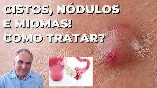 Cistos nódulos e miomas como resolver [upl. by Ppilihp]