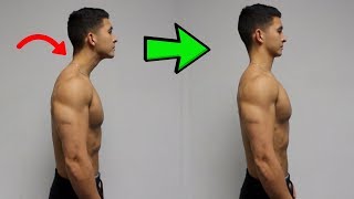 FIX Forward Head Posture Daily Corrective Routine [upl. by Antons693]