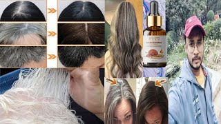 Ganoderma nutrient natural darkening  grey hair reverse  honest review [upl. by Ibbed803]