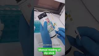 How to read urine dip stick laboratory urinalysis dipstick [upl. by Petuu]