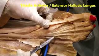 FOOT DORSUM Tendons Muscles Neurovascular and Clinical Correlations – Sanjoy Sanyal [upl. by Accebber]