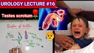 Urology surgery lecture 16 torsion of testis testicular appendages orchitis [upl. by Nanine]